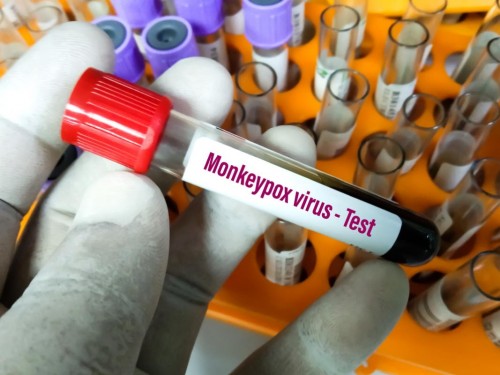 Canada issues travel notice as global monkeypox cases rise